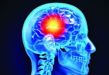 ‘BE FAST’ to recognize stroke signs Stroke signs