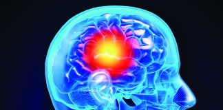 ‘BE FAST’ to recognize stroke signs Stroke signs